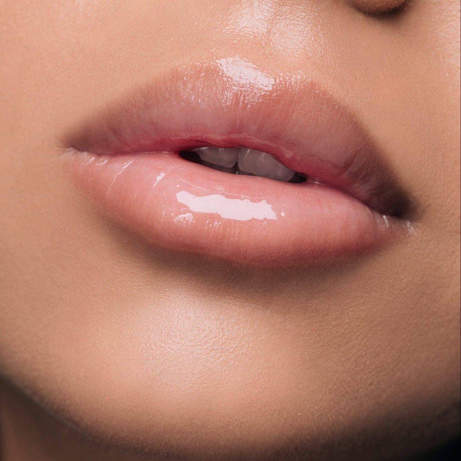 labios-relleno-alura-beauty-barcelona